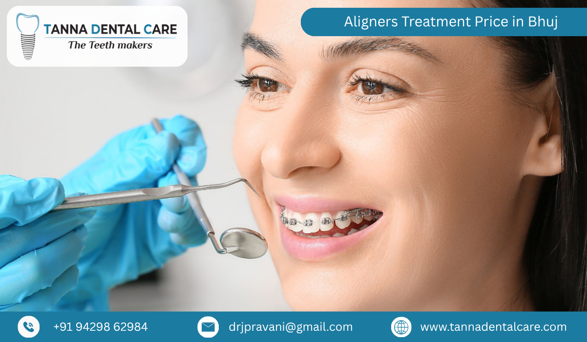 Aligners Treatment Price in Bhuj