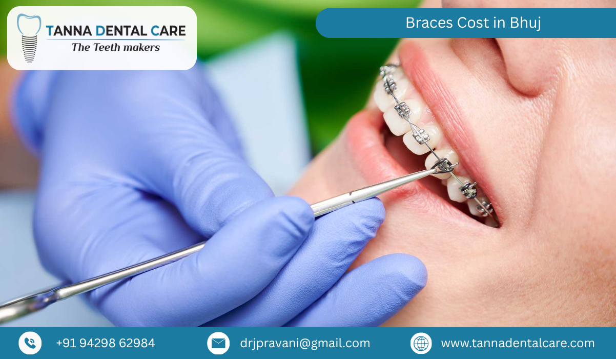 Braces Cost in Bhuj 