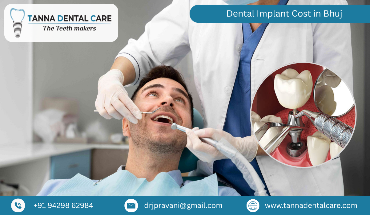 Dental Implant Cost in Bhuj 