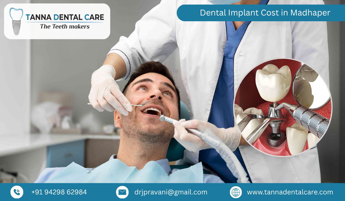 Dental Implant Cost in Madhaper