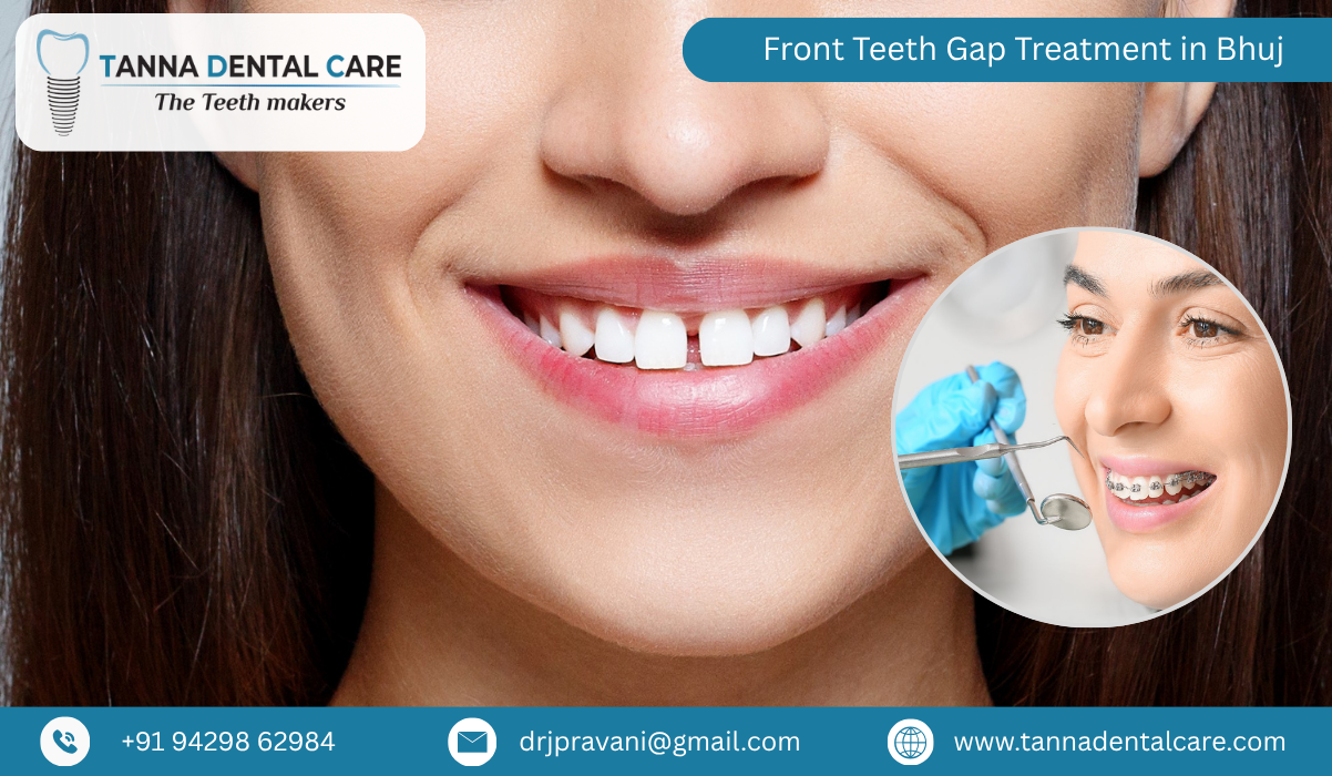 Front Teeth Gap Treatment in Bhuj