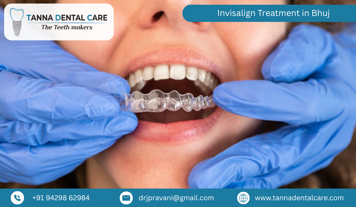 Invisalign Treatment in Bhuj