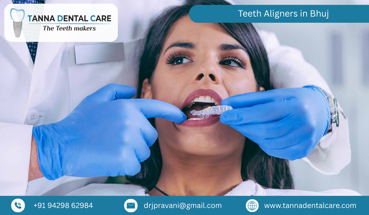 Teeth Aligners in Bhuj