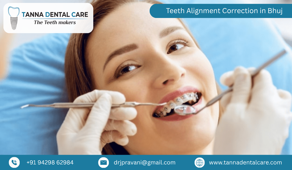 Teeth Alignment Correction in Bhuj