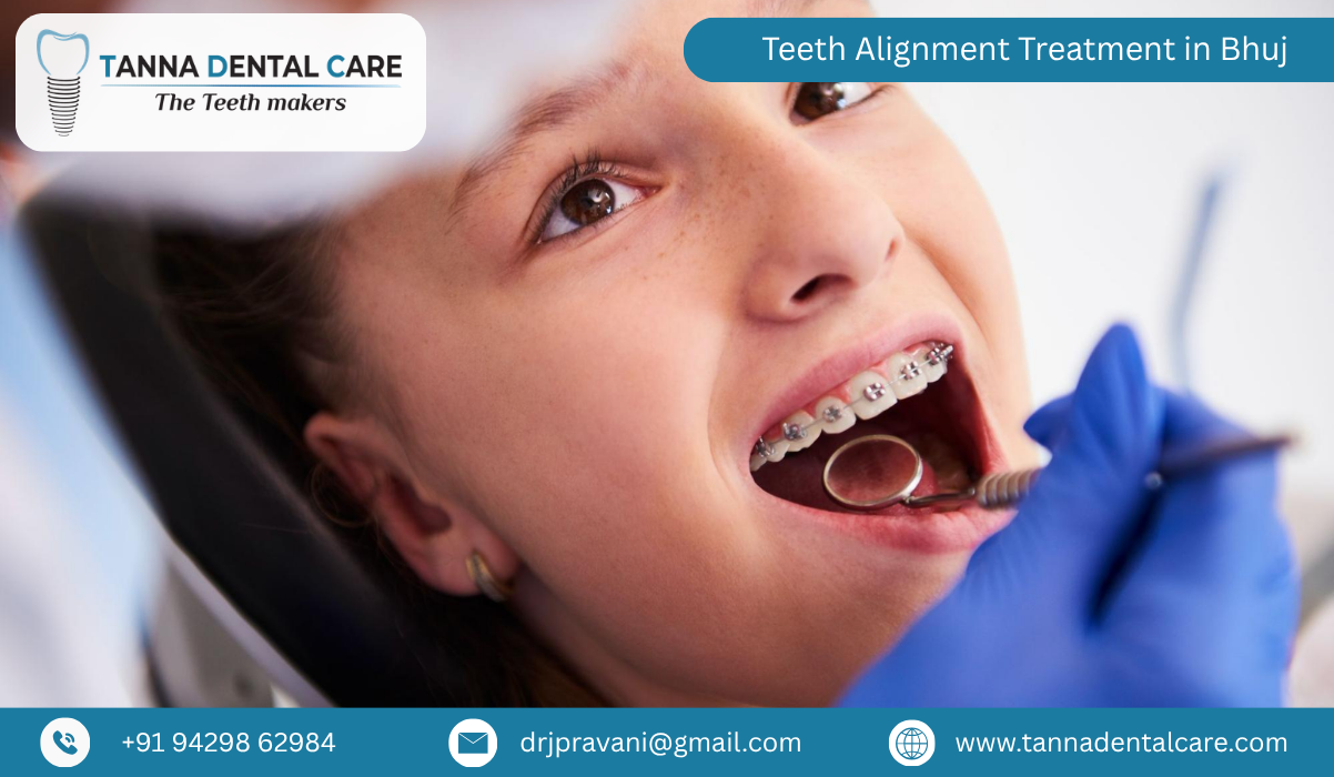 Teeth Alignment Treatment in Bhuj