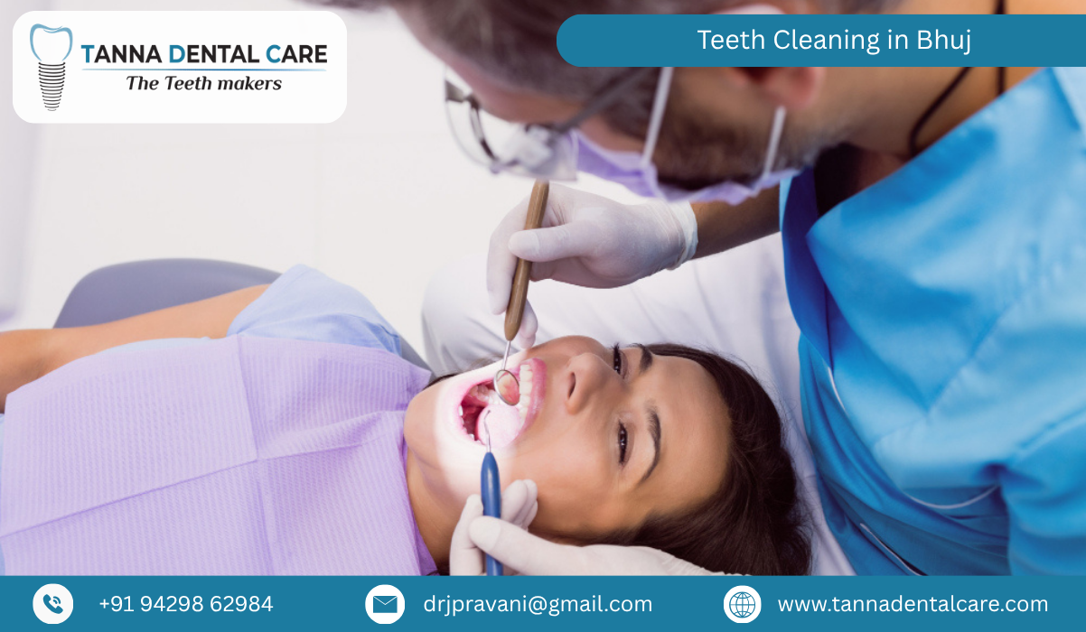 Teeth Cleaning in Bhuj 