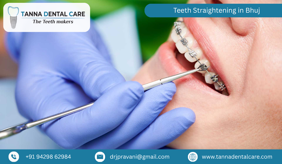 Teeth Straightening in Bhuj