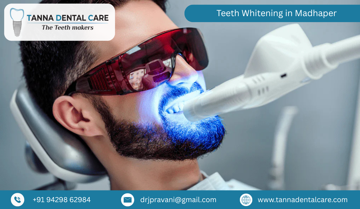 Teeth Whitening in Madhaper